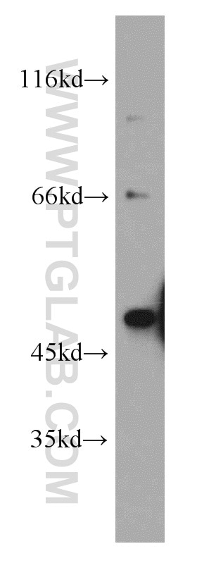 Western Blot (WB) analysis of mouse heart tissue using B3GALT2 Polyclonal antibody (14177-1-AP)