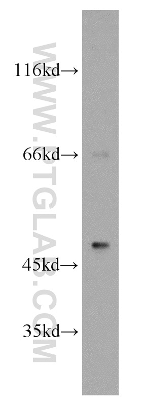 Western Blot (WB) analysis of mouse brain tissue using B3GALT2 Polyclonal antibody (14177-1-AP)