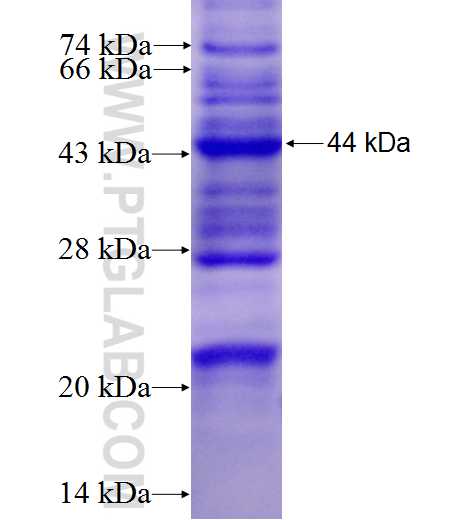 B3GALT2 fusion protein Ag5384 SDS-PAGE