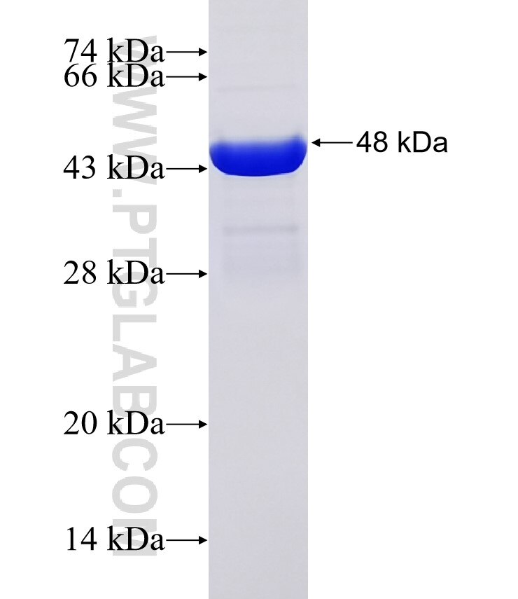 B3GALT4 fusion protein Ag31515 SDS-PAGE B3GALT4 fusion protein Ag31515 SDS-PAGE