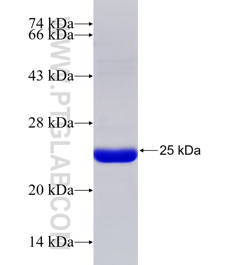 B3GALT4 fusion protein Ag31524 SDS-PAGE