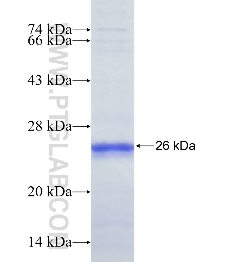 B3GALT5 fusion protein Ag39081 SDS-PAGE