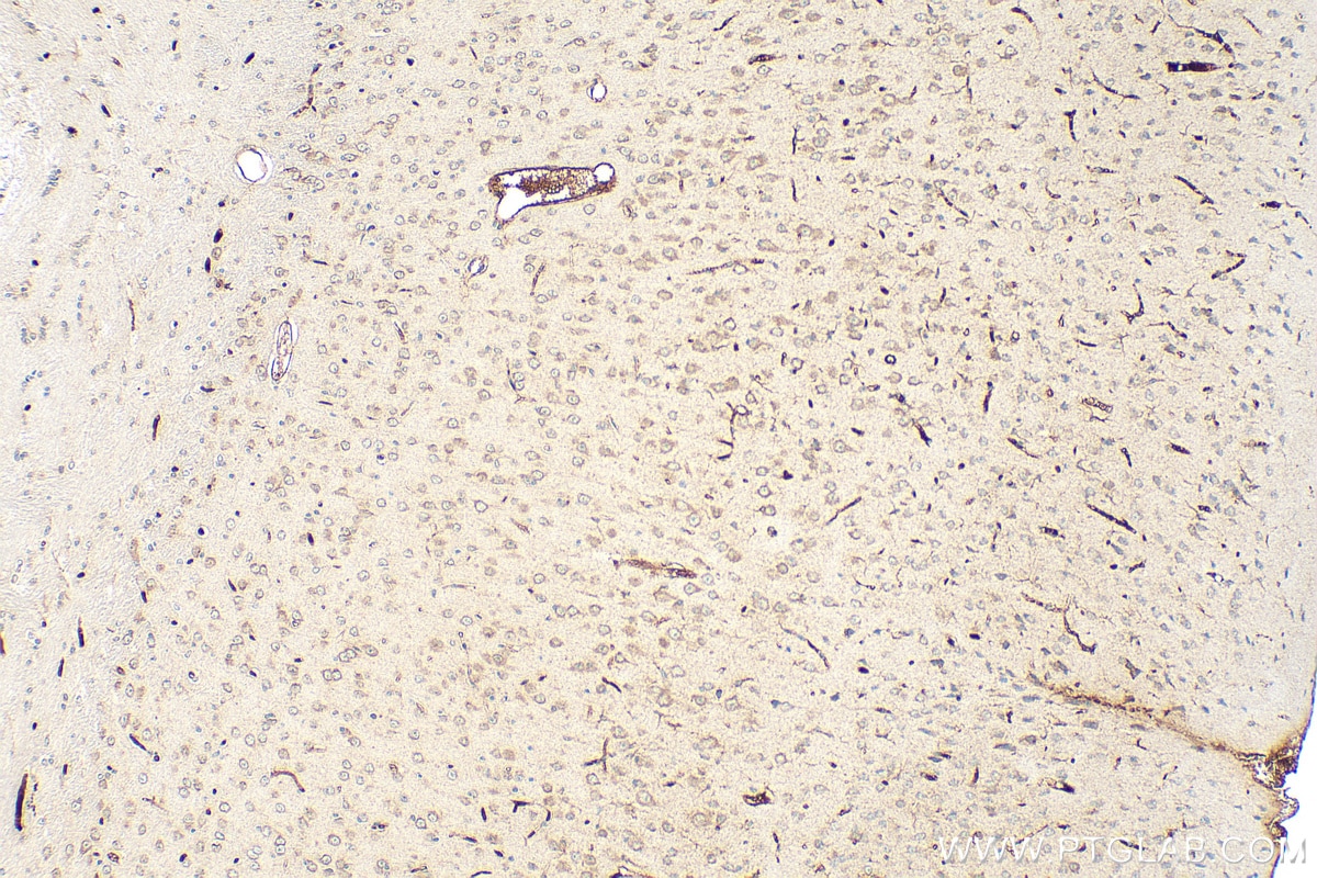 Immunohistochemistry (IHC) staining of mouse brain tissue using B3GALT6 Polyclonal antibody (55049-1-AP)