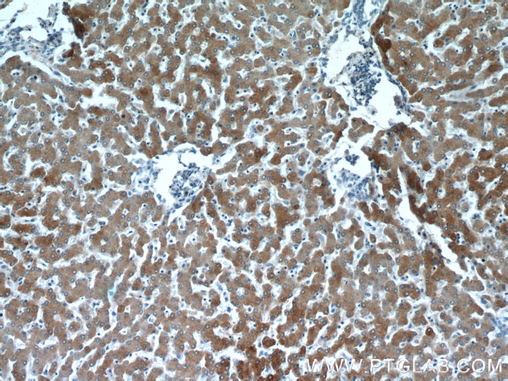 Immunohistochemistry (IHC) staining of human liver tissue using B3GALT6 Polyclonal antibody (55049-1-AP)