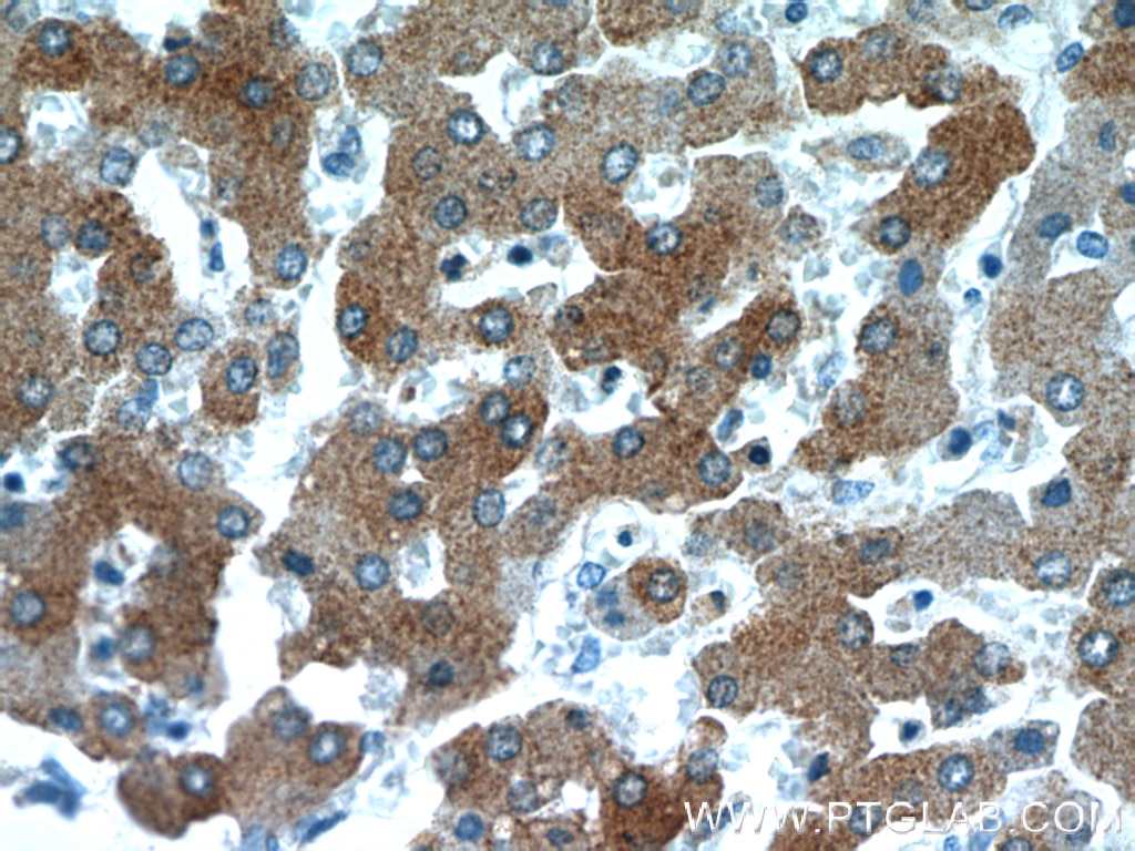Immunohistochemistry (IHC) staining of human liver tissue using B3GALT6 Polyclonal antibody (55049-1-AP)