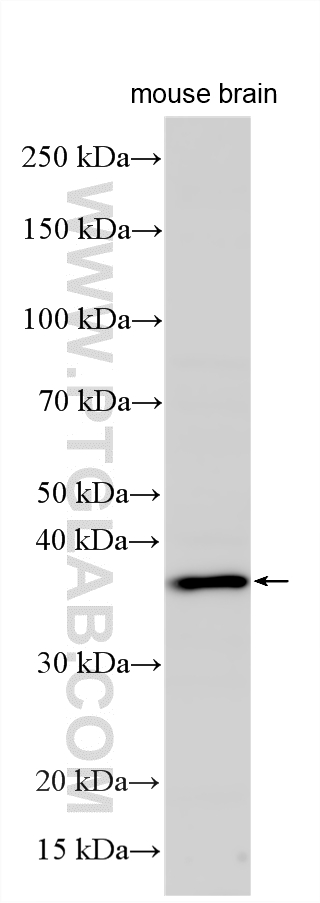 Western Blot (WB) analysis of various lysates using B3GALT6 Polyclonal antibody (55049-1-AP)