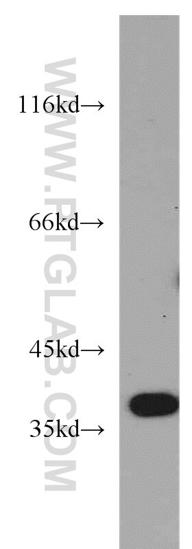 Western Blot (WB) analysis of mouse brain tissue using B3GALT6 Polyclonal antibody (55049-1-AP)