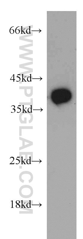 Western Blot (WB) analysis of mouse liver tissue using B3GALT6 Polyclonal antibody (55049-1-AP)