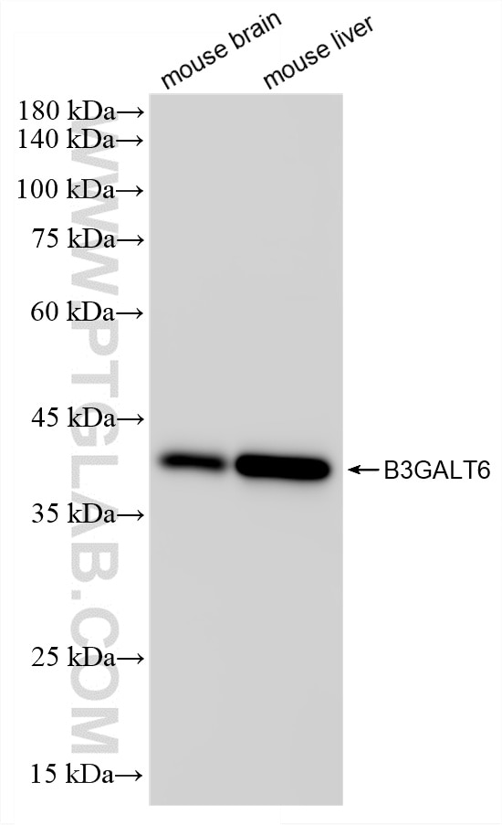 Western Blot (WB) analysis of various lysates using B3GALT6 Recombinant monoclonal antibody (87370-1-RR)