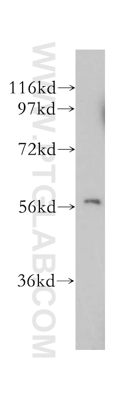 WB analysis of mouse skeletal muscle using 14601-1-AP