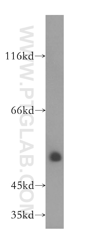WB analysis of human heart using 14601-1-AP