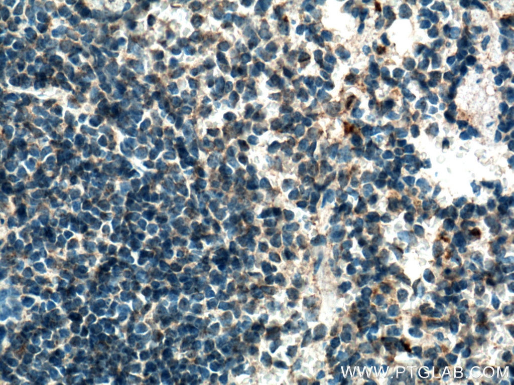 Immunohistochemistry (IHC) staining of mouse spleen tissue using CD57 Polyclonal antibody (19401-1-AP)