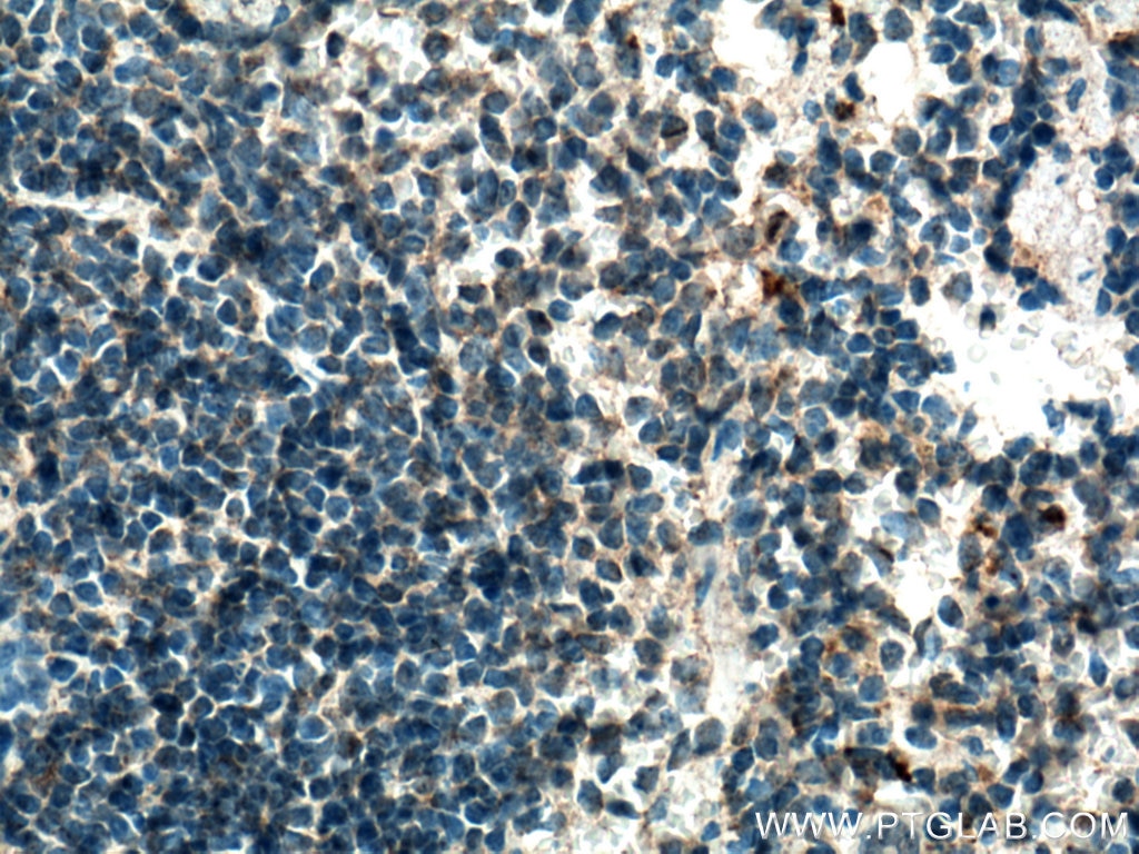 IHC staining of mouse spleen using 19401-1-AP