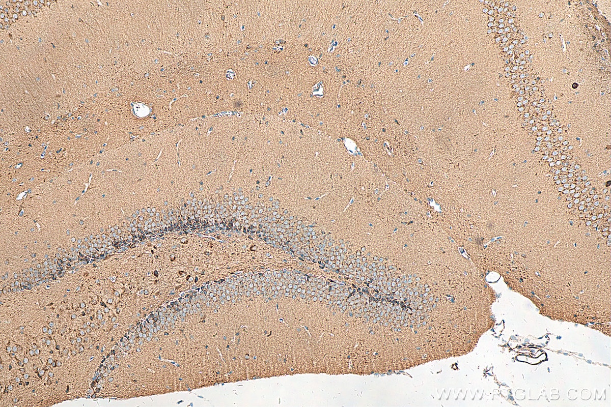 Immunohistochemistry (IHC) staining of mouse brain tissue using CD57 Polyclonal antibody (19401-1-AP)