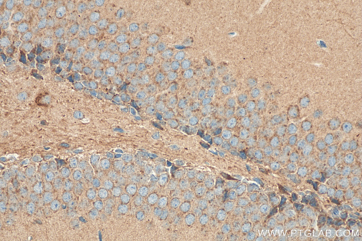 Immunohistochemistry (IHC) staining of mouse brain tissue using CD57 Polyclonal antibody (19401-1-AP)