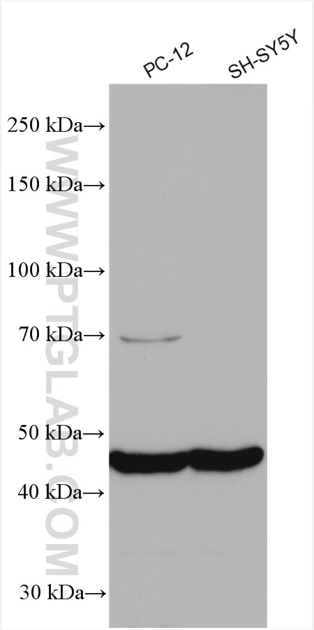 Western Blot (WB) analysis of various lysates using CD57 Polyclonal antibody (19401-1-AP)