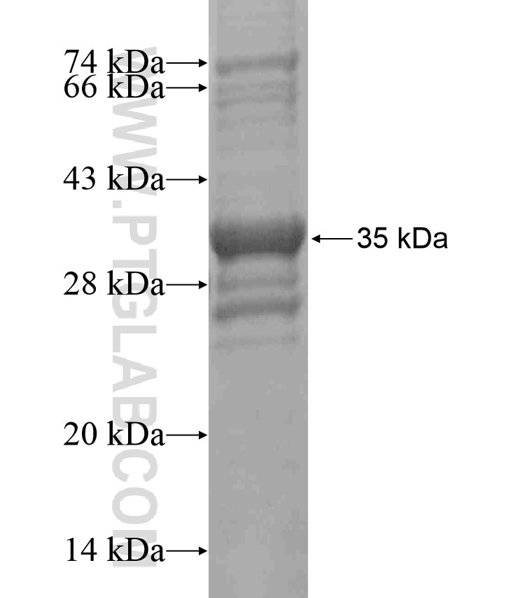 B3GAT2 fusion protein Ag18402 SDS-PAGE