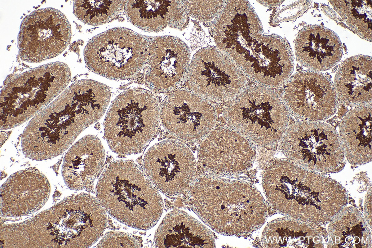 Immunohistochemistry (IHC) staining of mouse testis tissue using B3GNT2 Polyclonal antibody (14200-1-AP)