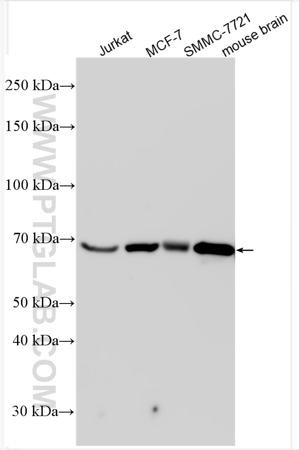 Western Blot (WB) analysis of various lysates using B3GNT2 Polyclonal antibody (14200-1-AP)