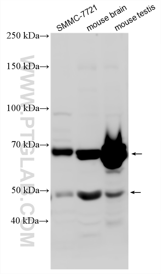 Western Blot (WB) analysis of various lysates using B3GNT2 Polyclonal antibody (14200-1-AP)