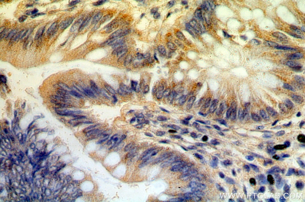 Immunohistochemistry (IHC) staining of human colon tissue using B3GNT3 Polyclonal antibody (18098-1-AP)