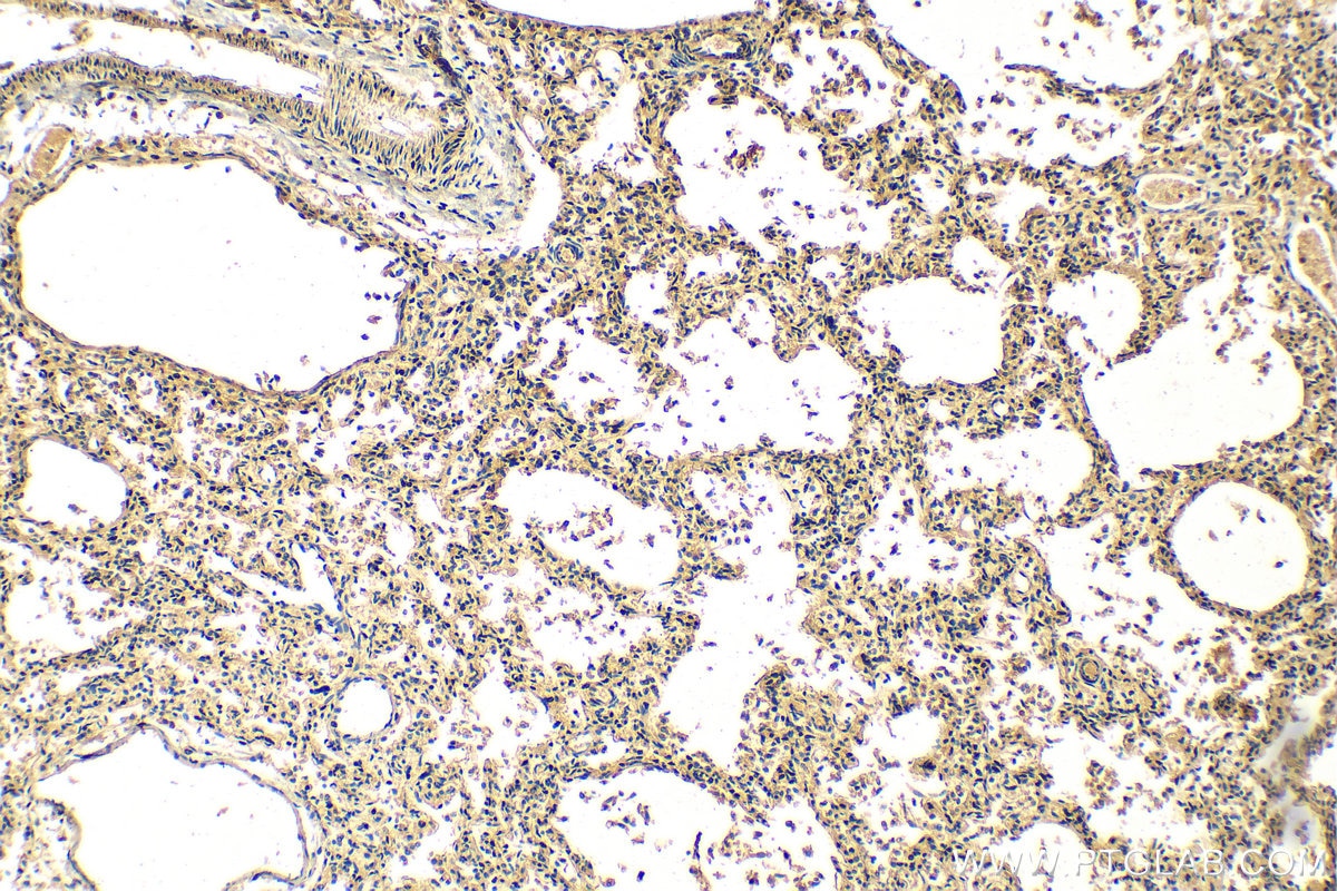 Immunohistochemistry (IHC) staining of human lung tissue using B3GNT5 Polyclonal antibody (20422-1-AP)