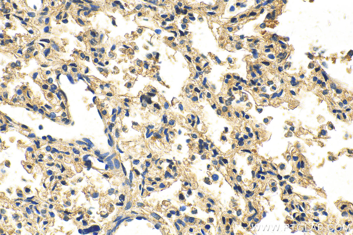 Immunohistochemistry (IHC) staining of human lung tissue using B3GNT5 Polyclonal antibody (20422-1-AP)