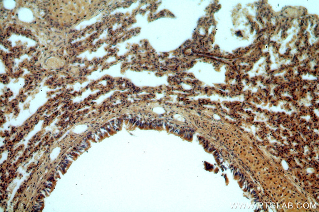 Immunohistochemistry (IHC) staining of human lung tissue using B3GNT5 Polyclonal antibody (20422-1-AP)