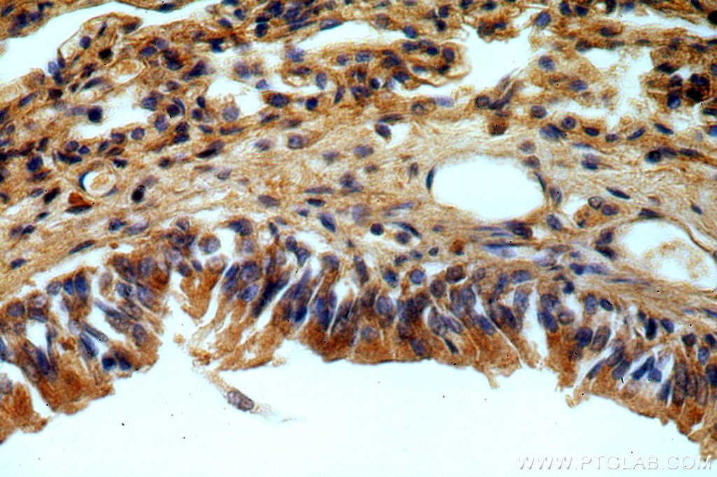 Immunohistochemistry (IHC) staining of human lung tissue using B3GNT5 Polyclonal antibody (20422-1-AP)