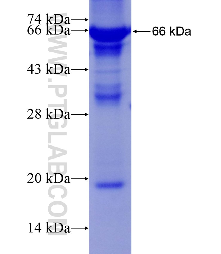 B3GNT5 fusion protein Ag14246 SDS-PAGE