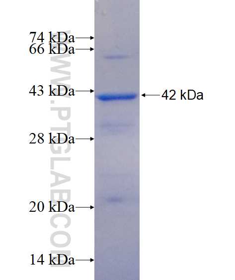 B3GNT5 fusion protein Ag14721 SDS-PAGE