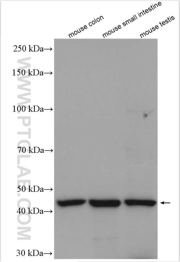 Western Blot (WB) analysis of various lysates using B3GNT6 Polyclonal antibody (21291-1-AP)