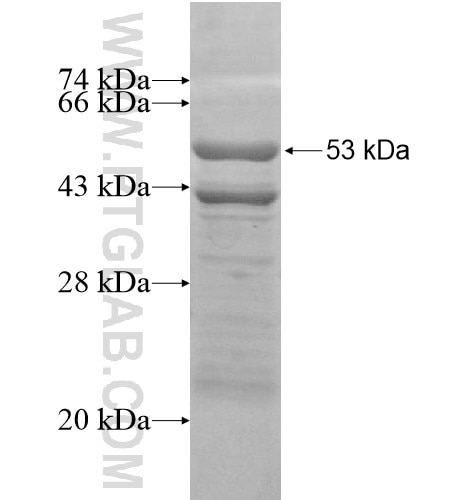 B3GNT6 fusion protein Ag15825 SDS-PAGE