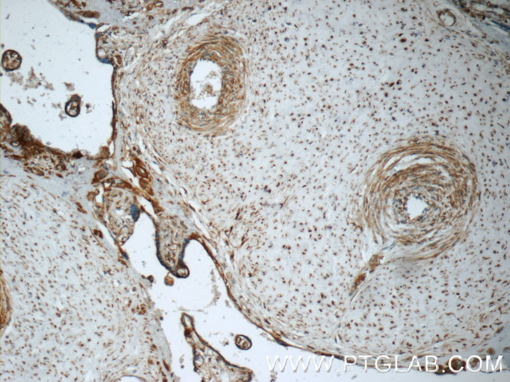 Immunohistochemistry (IHC) staining of human placenta tissue using B3GNT7 Polyclonal antibody (22879-1-AP)