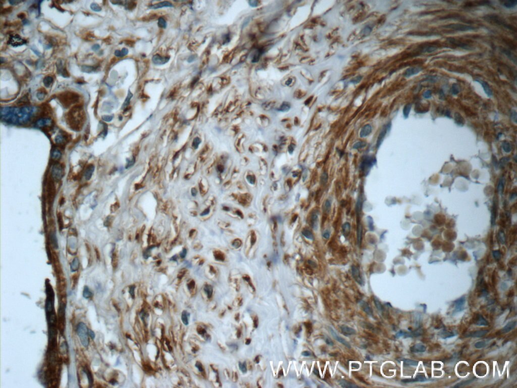 Immunohistochemistry (IHC) staining of human placenta tissue using B3GNT7 Polyclonal antibody (22879-1-AP)
