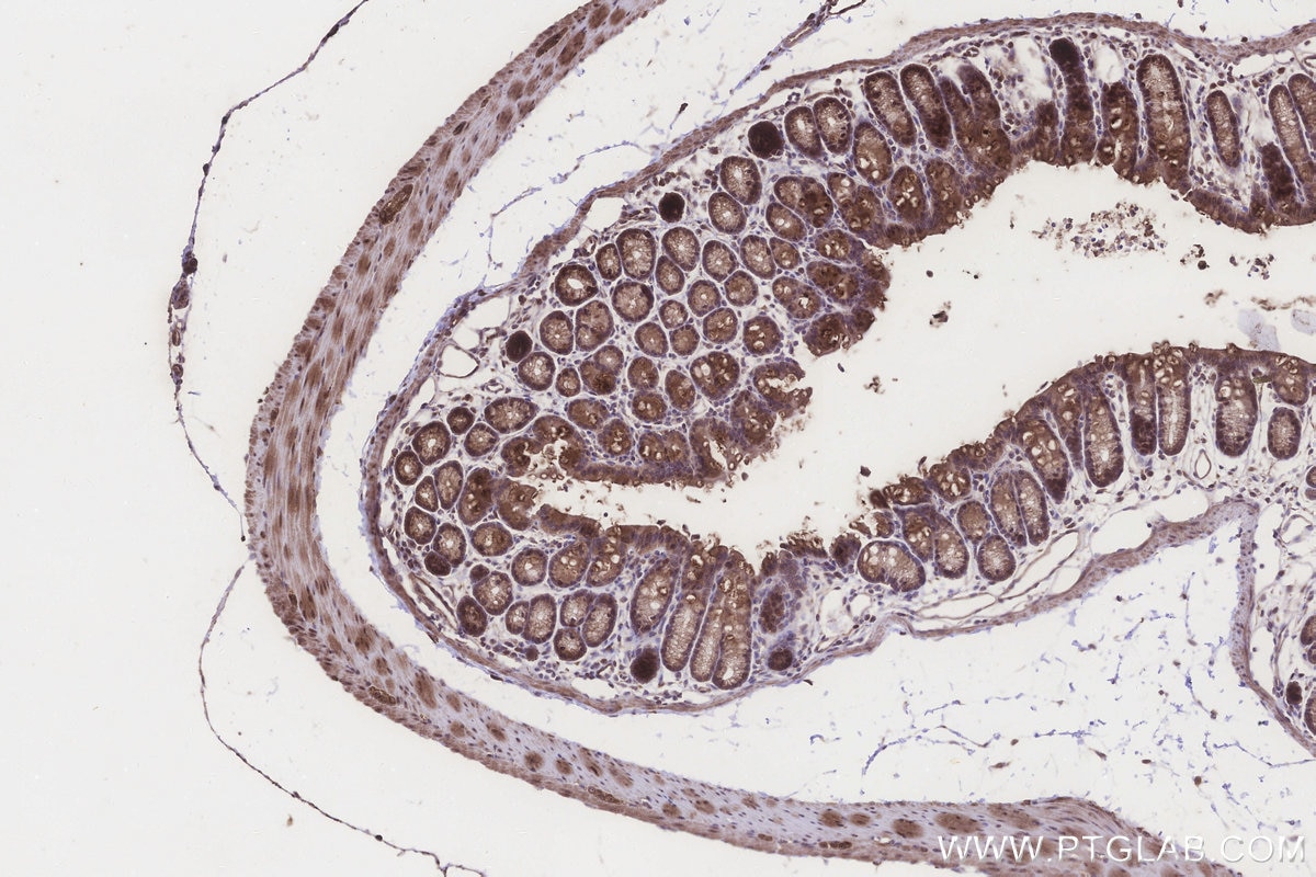 Immunohistochemistry (IHC) staining of mouse colon tissue using B3GNT7 Polyclonal antibody (22879-1-AP)