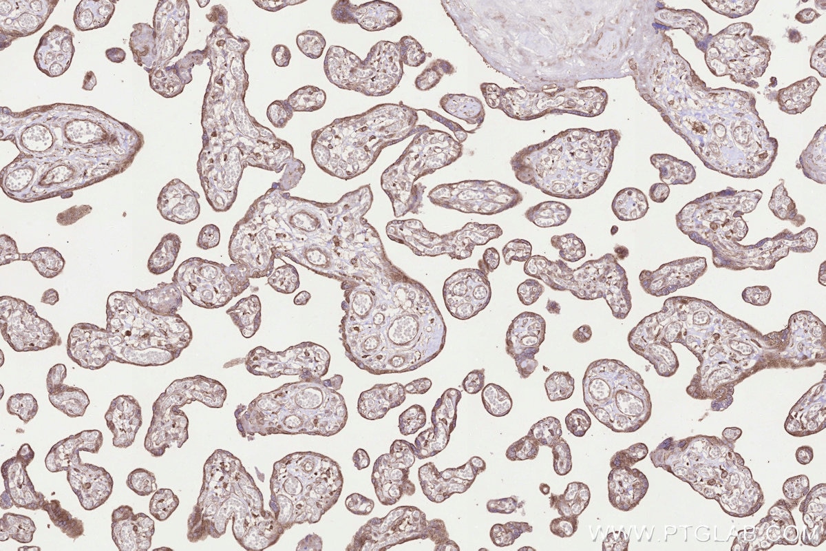 Immunohistochemistry (IHC) staining of human placenta tissue using B3GNT7 Polyclonal antibody (22879-1-AP)