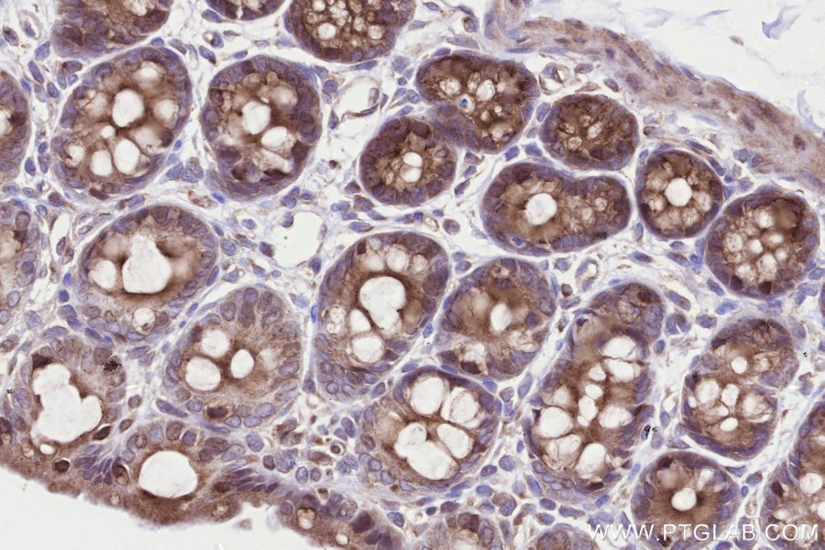 Immunohistochemistry (IHC) staining of rat colon tissue using B3GNT7 Polyclonal antibody (22879-1-AP)