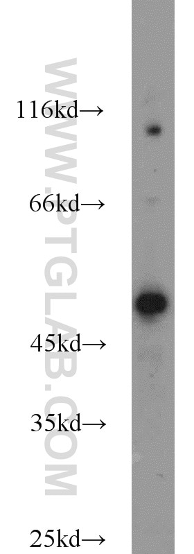 Western Blot (WB) analysis of Jurkat cells using B3GNT7 Polyclonal antibody (22879-1-AP)