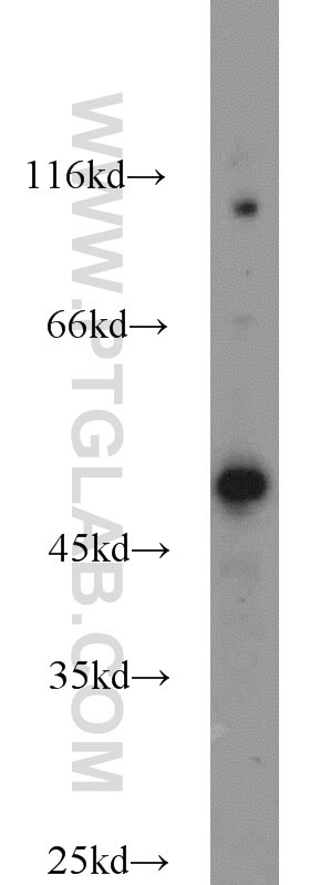 Western Blot (WB) analysis of Jurkat cells using B3GNT7 Polyclonal antibody (22879-1-AP)