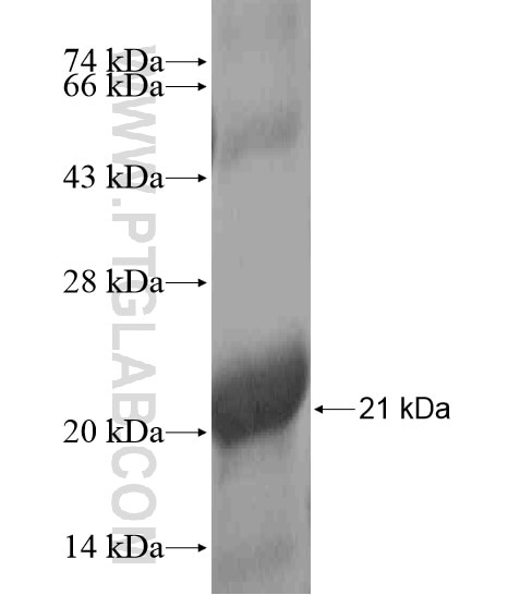 B3GNT7 fusion protein Ag18890 SDS-PAGE