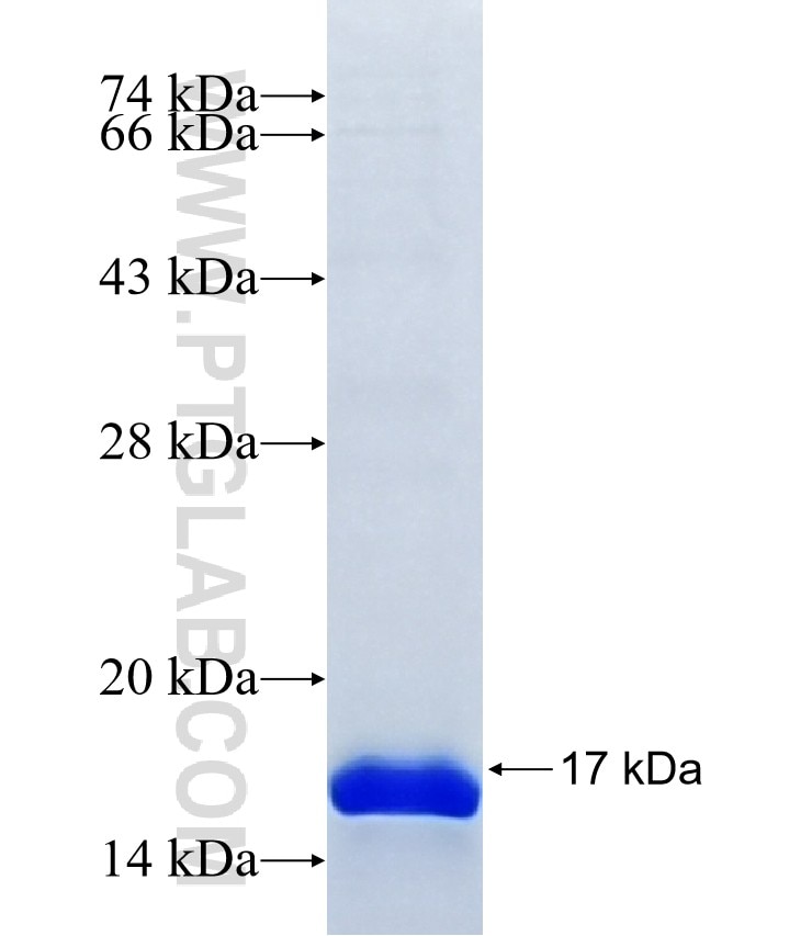 B3GNT8 fusion protein Ag41122 SDS-PAGE B3GNT8 fusion protein Ag41122 SDS-PAGE