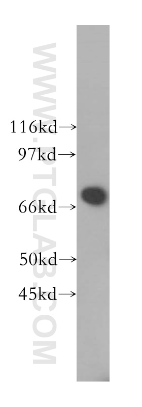 Western Blot (WB) analysis of COLO 320 cells using B4GALNT1 Polyclonal antibody (13396-1-AP)