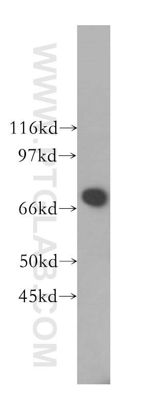 WB analysis of COLO 320 using 13396-1-AP