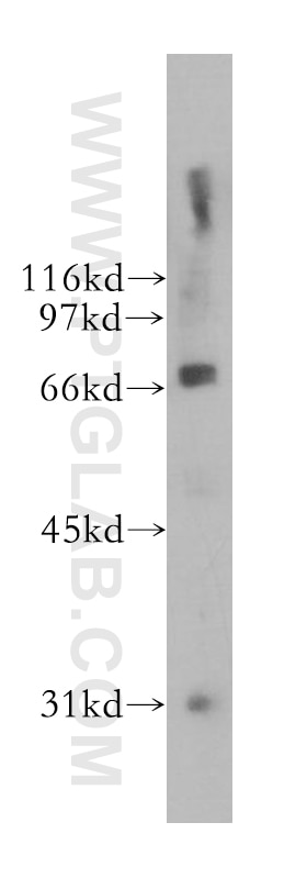 Western Blot (WB) analysis of A375 cells using B4GALNT1 Polyclonal antibody (13396-1-AP)
