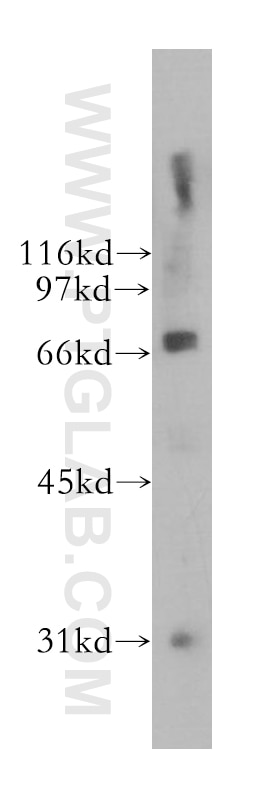 WB analysis of A375 using 13396-1-AP