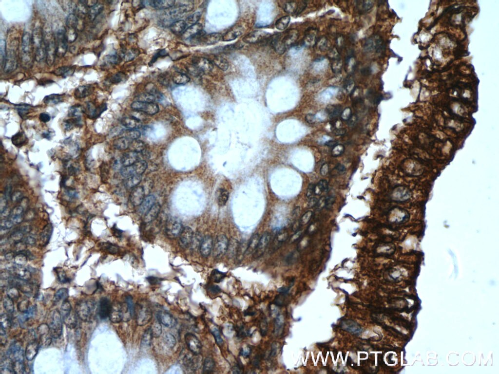 Immunohistochemistry (IHC) staining of human colon tissue using B4GALNT2 Polyclonal antibody (24024-1-AP)