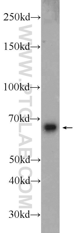 Western Blot (WB) analysis of Jurkat cells using B4GALNT2 Polyclonal antibody (24024-1-AP)