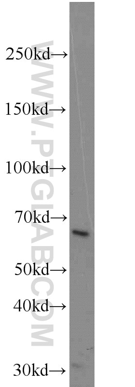 Western Blot (WB) analysis of COLO 320 cells using B4GALNT2 Polyclonal antibody (24024-1-AP)