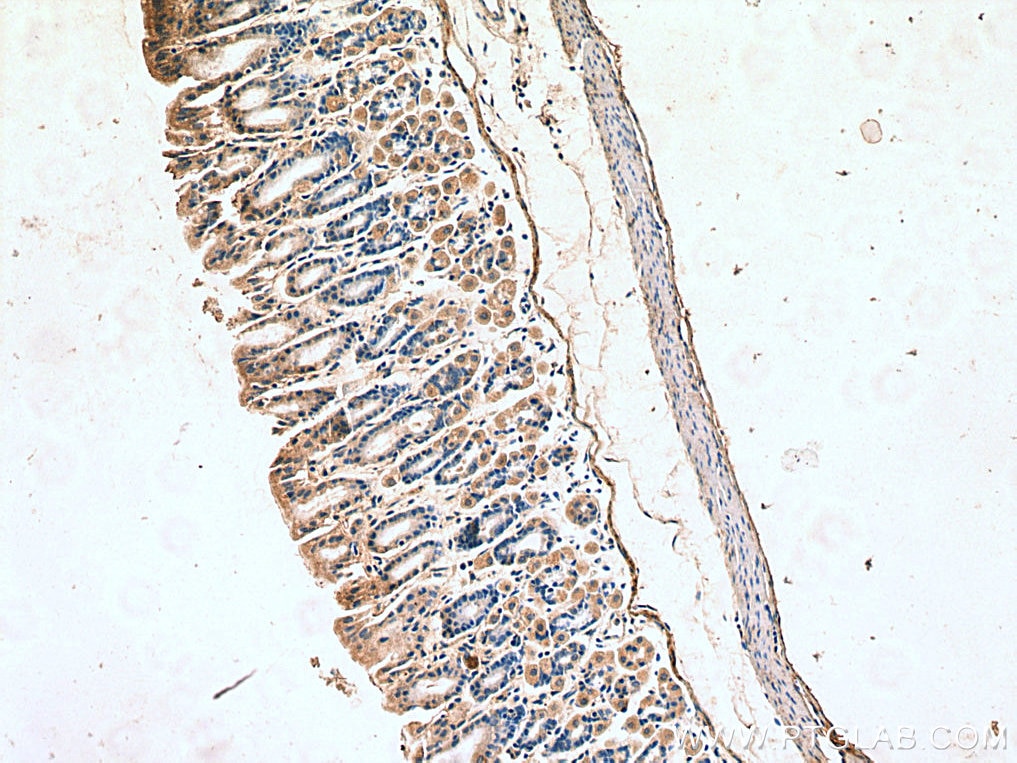 Immunohistochemistry (IHC) staining of mouse stomach tissue using B4GALNT3 Polyclonal antibody (24675-1-AP)